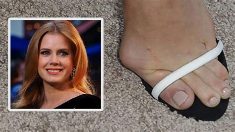 celebrity ugly toes|Reveal: Gnarly Celeb Feet .